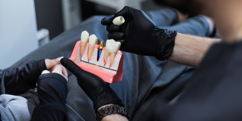 Безкоштовна консультація по протезуванню